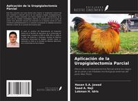 Produktbild: Aplicaci&oacute;n de la Uropigialectom&iacute;a Parcial