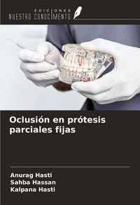 Produktbild: Oclusi&oacute;n en pr&oacute;tesis parciales fijas