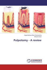 Produktbild: Pulpotomy - A review