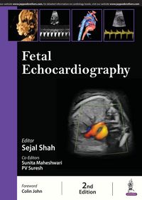 Produktbild: Fetal Echocardiography