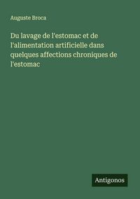 Produktbild: Du lavage de l'estomac et de l'alimentation artificielle dans quelques affections chroniques de l'estomac