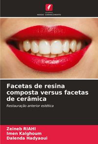 Produktbild: Facetas de resina composta versus facetas de cer&acirc;mica