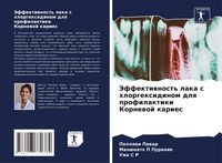 Produktbild: Jeffektiwnost' laka s hlorgexidinom dlq profilaktiki Kornewoj karies