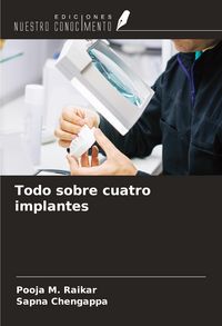 Produktbild: Todo sobre cuatro implantes