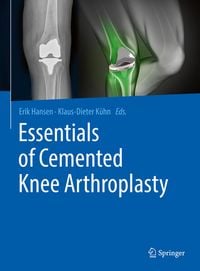 Produktbild: Essentials of Cemented Knee Arthroplasty