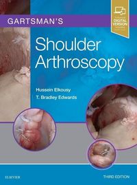 Produktbild: Gartsman's Shoulder Arthroscopy
