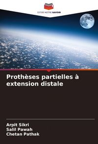 Produktbild: Proth&egrave;ses partielles &agrave; extension distale