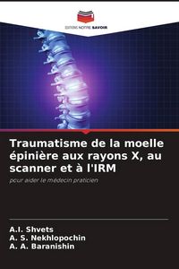 Produktbild: Traumatisme de la moelle &eacute;pini&egrave;re aux rayons X, au scanner et &agrave; l'IRM