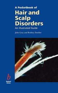 Produktbild: Pocketbook of Hair and Scalp Disorders