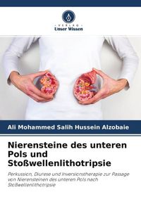Produktbild: Nierensteine des unteren Pols und Sto&szlig;wellenlithotripsie