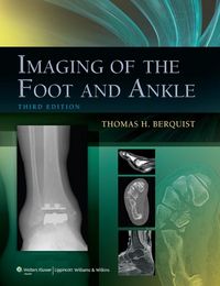 Produktbild: Imaging of the Foot and Ankle