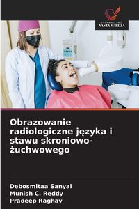 Produktbild: Obrazowanie radiologiczne j&iquest;zyka i stawu skroniowo-&iquest;uchwowego