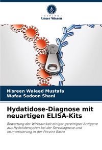 Produktbild: Hydatidose-Diagnose mit neuartigen ELISA-Kits