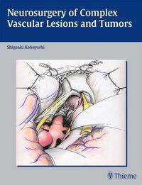 Produktbild: Neurosurgery of Complex Vascular Lesions and Tumors