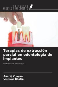Produktbild: Terapias de extracci&oacute;n parcial en odontolog&iacute;a de implantes