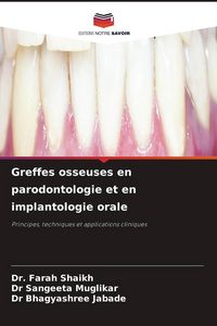 Produktbild: Greffes osseuses en parodontologie et en implantologie orale