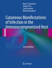 Produktbild: Cutaneous Manifestations of Infection in the Immunocompromised Host