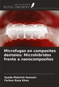 Produktbild: Microfugas en composites dentales: Microh&iacute;bridos frente a nanocomposites