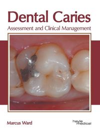 Produktbild: Dental Caries