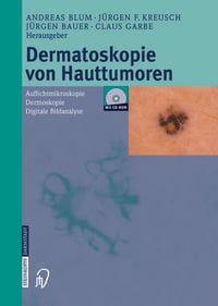 Produktbild: Dermatoskopie von Hauttumoren