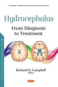 Produktbild: Hydrocephalus: From Diagnosis to Treatment