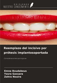 Produktbild: Reemplazo del incisivo por pr&oacute;tesis implantosoportada