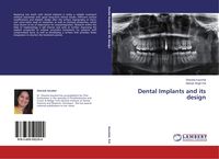 Produktbild: Dental Implants and its design