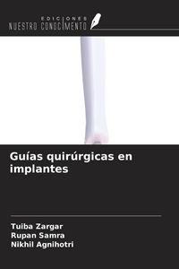 Produktbild: Gu&iacute;as quir&uacute;rgicas en implantes