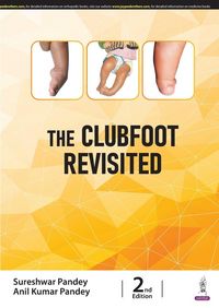Produktbild: The Clubfoot Revisited
