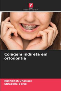 Produktbild: Colagem indireta em ortodontia