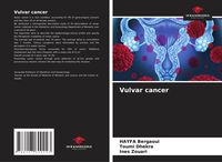 Produktbild: Vulvar cancer