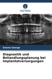 Produktbild: Diagnostik und Behandlungsplanung bei Implantatversorgungen