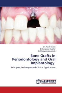 Produktbild: Bone Grafts in Periodontology and Oral Implantology