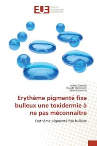 Produktbild: Eryth&egrave;me pigment&eacute; fixe bulleux une toxidermie &agrave; ne pas m&eacute;conna&icirc;tre