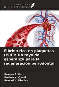 Produktbild: Fibrina rica en plaquetas (PRF): Un rayo de esperanza para la regeneraci&oacute;n periodontal
