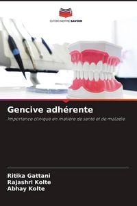 Produktbild: Gencive adh&eacute;rente