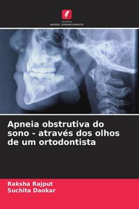 Produktbild: Apneia obstrutiva do sono - atrav&eacute;s dos olhos de um ortodontista