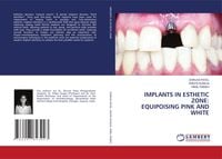 Produktbild: Implants in Esthetic Zone: Equipoising Pink and White