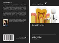 Produktbild: Extrusi&oacute;n apical