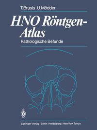 Produktbild: HNO R&ouml;ntgen-Atlas