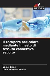 Produktbild: Il recupero radicolare mediante innesto di tessuto connettivo sepolto