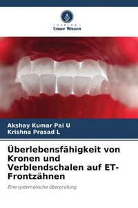 Produktbild: &Uuml;berlebensf&auml;higkeit von Kronen und Verblendschalen auf ET-Frontz&auml;hnen
