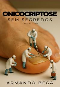 Produktbild: Onicocriptose Sem Segredos