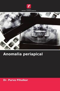 Produktbild: Anomalia periapical