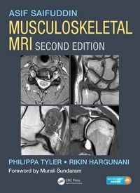 Produktbild: Saifuddin, A: Musculoskeletal MRI