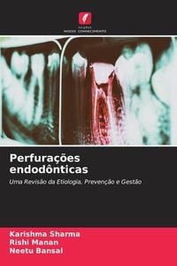 Produktbild: Perfura&ccedil;&otilde;es endod&ocirc;nticas