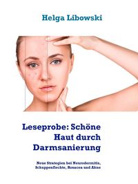 Produktbild: Leseprobe: Sch&ouml;ne Haut durch Darmsanierung