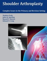 Produktbild: Shoulder Arthroplasty