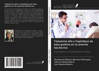 Produktbild: Talasemia alfa y haplotipos de beta globina en la anemia falciforme
