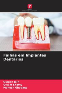 Produktbild: Falhas em Implantes Dent&aacute;rios